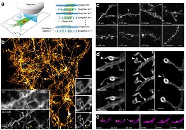 我国科研人员开发出清醒动物超分辨光学显微